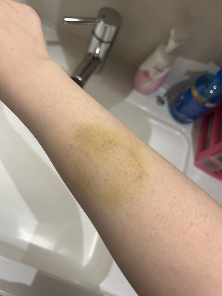 加害者美樹(みき)こと嶋田光希(しまだ みつき)の傷害事案の証拠