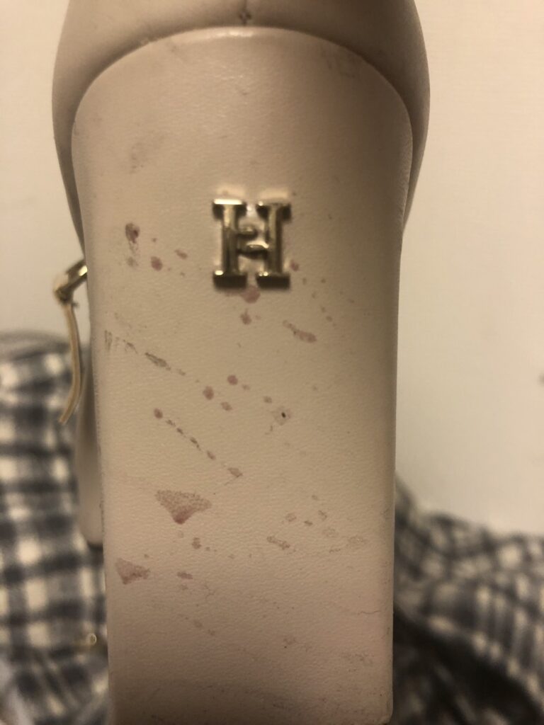 志尊ゆう／TOP DANDY トップダンディー／クラッシュ事案（写真：被害者女性のブーツ）